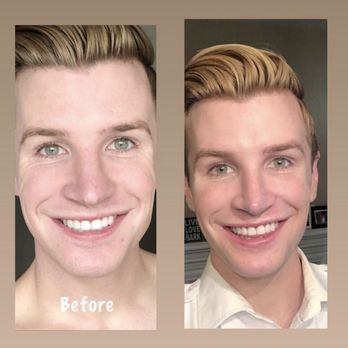 Tamplen Plastic Surgery - Rhinoplasty - Plastic Surgeons Near Me - Orinda, California Tamplen Plastic Surgery - Rhinoplasty - Plastic Surgeons Near Me - Orinda, California