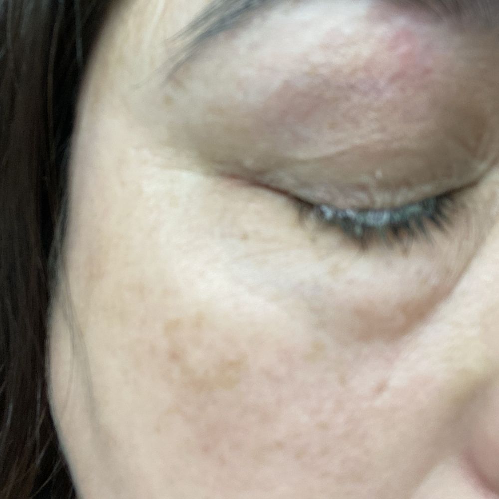 Ali Cat's Spa - Solution clumped up - Skin Care Near Me - Mesa, Arizona Ali Cat's Spa - Solution clumped up - Skin Care Near Me - Mesa, Arizona