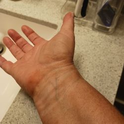 Glow Bar - It is on my hand and there are lines on both of my wrists