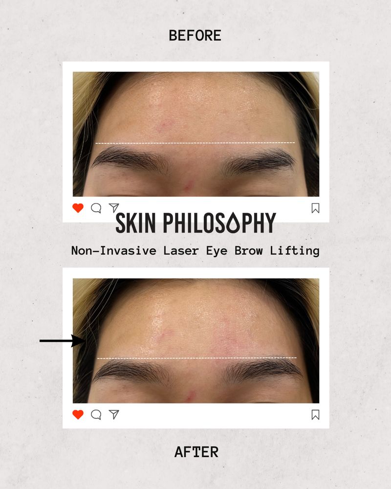 Skin Philosophy Logo