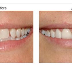 Gourgen Almasi, DDS