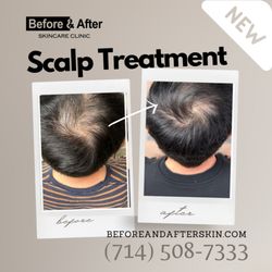 Before & After Skincare Clinic - Scalp Treatment