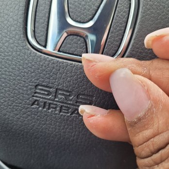 Brandon Nails & Spa - Closer picture of my sliced fingers - Nail Salons Near Me - Irvington, New Jersey