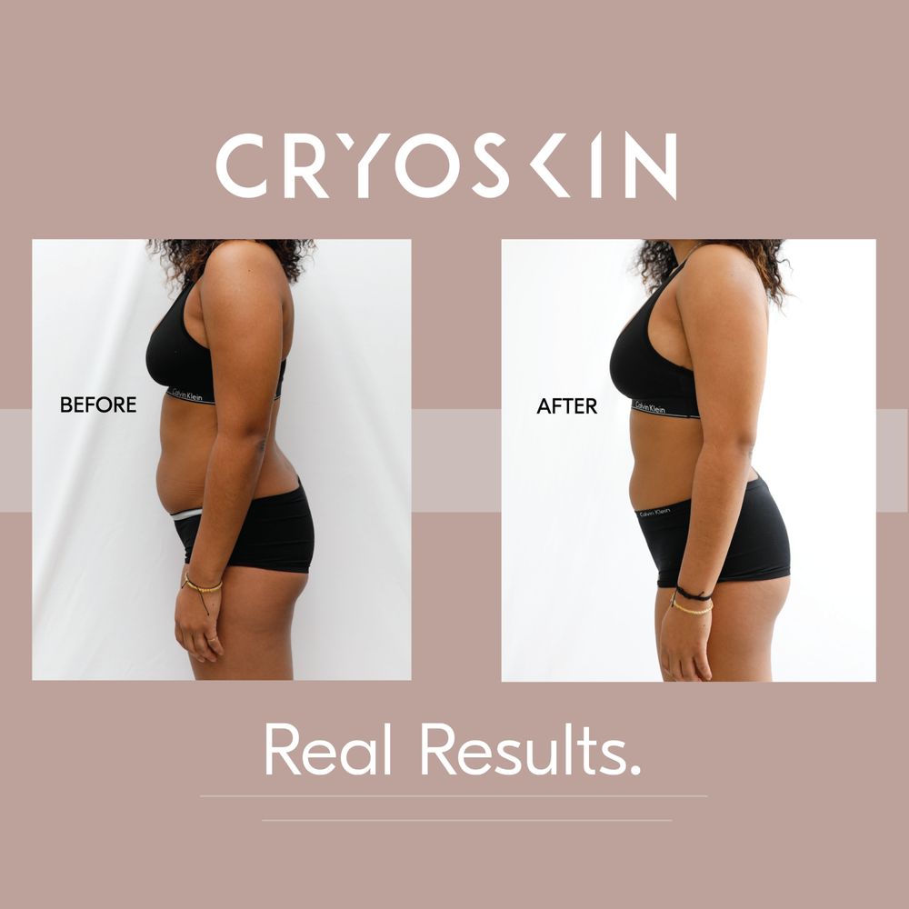 Cryo Health Clinic Logo