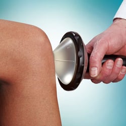Bay Area Pain Relief Center - Extracorporeal Shockwave Pain Therapy by Dr. Shive in San Mateo California