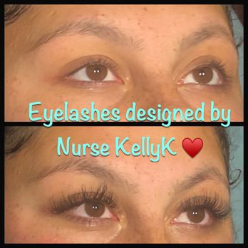 United Nurses Medi Spa - Medical Spas Near Me United Nurses Medi Spa - Medical Spas Near Me