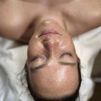 Pura Vida Bella - After - Skin Care Near Me - Sacramento, California Pura Vida Bella - After - Skin Care Near Me - Sacramento, California