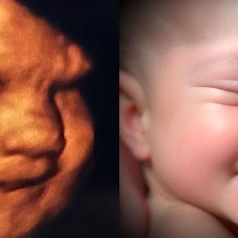 Chubby Cheeks 3D/4D Ultrasound Studio of High Point & Greensboro - Ultrasound Imaging Centers Near Me - High Point, North Carolina