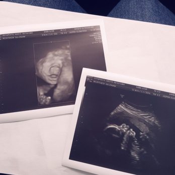 Unique Ultrasound - Baby #4 A girl! 24 weeks! - Diagnostic Imaging Near Me - Temecula, California Unique Ultrasound - Baby #4 A girl! 24 weeks! - Diagnostic Imaging Near Me - Temecula, California