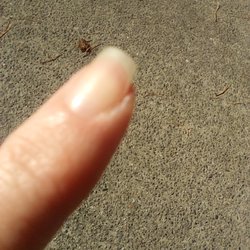 Hi Tek Nails - Index finger cut too short on the side.