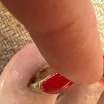 Creative Nails & Spa - She ripped off my toenail - Nail Salons Near Me - Tacoma, Washington Creative Nails & Spa - She ripped off my toenail - Nail Salons Near Me - Tacoma, Washington