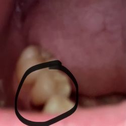 Sanger Martha H, DDS - Teeth