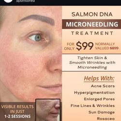 Skin MD - Within one week, their AD is different. I saw The one with "RF" on 7/20, and without "RF" yesterday (7/27).