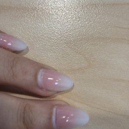 Red "rings of fire" on nail beds