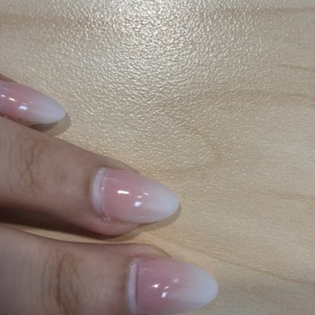 Aura Bodhi Nails Spa - Red "rings of fire" on nail beds - Nail Salons Near Me - San Jose, California