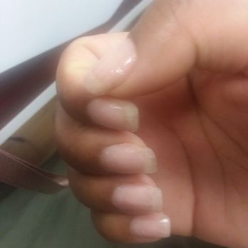 Queen Bee Nails and Spa - These are my nails before I got them done at Queen Bee. I just peeled off acrylics and put a quick polish on myself. - Nail Salons Near Me - Brighton, Massachusetts Queen Bee Nails and Spa - These are my nails before I got them done at Queen Bee. I just peeled off acrylics and put a quick polish on myself. - Nail Salons Near Me - Brighton, Massachusetts