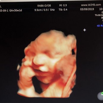 4D Imaging - Diagnostic Imaging Near Me - Crystal Lake, Illinois 4D Imaging - Diagnostic Imaging Near Me - Crystal Lake, Illinois