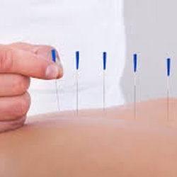 Alfred Jun BAO Acupuncture & Herb Medicine Clinic