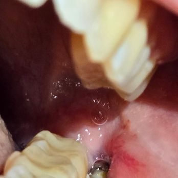 Mesa Grand Dental Group - What the dentist said looked normal - Dental Hygienists Near Me - Mesa, Arizona Mesa Grand Dental Group - What the dentist said looked normal - Dental Hygienists Near Me - Mesa, Arizona