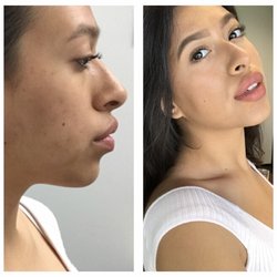 Oral & Maxillofacial Surgery of Chicago