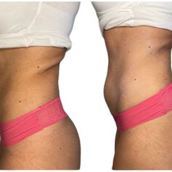 Barehandspa - Body Sculpting with a few sessions you can burn fat and tighten the skin