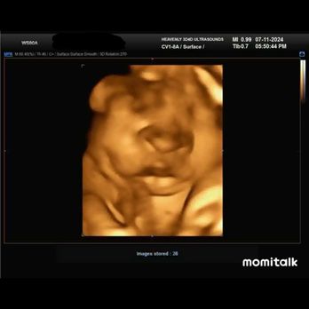 Heavenly 3D4D Ultrasound - Downloaded from the app - Diagnostic Imaging Near Me - Riverside, California Heavenly 3D4D Ultrasound - Downloaded from the app - Diagnostic Imaging Near Me - Riverside, California