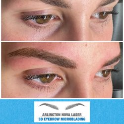 Arlington NOVA Laser & 3D Microblading