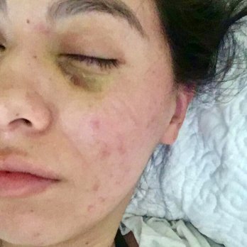 Botox by Shahnaz - Medical Spas Near Me - Santa Ana, California Botox by Shahnaz - Medical Spas Near Me - Santa Ana, California