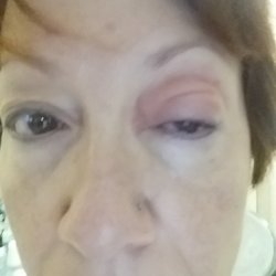 Binita Mandal, MD