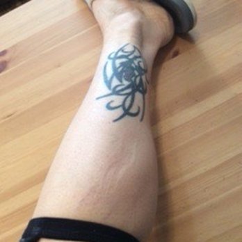 Legend Ink SF - Before: Old tattoo - Tattoo Near Me - San Francisco, California Legend Ink SF - Before: Old tattoo - Tattoo Near Me - San Francisco, California
