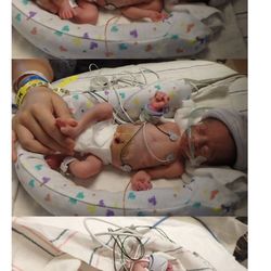 Alice Yun, MD - My son was born two months early only 2 pounds  was hospitalized 58 days please stay was from this doctor