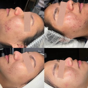 Guya Aesthetics - Aestheticians Near Me - Cypress, California Guya Aesthetics - Aestheticians Near Me - Cypress, California