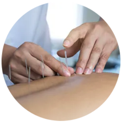 KAM Medical Acupuncture