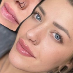 ECHO Med - Blended lip liner to bring her shape back!