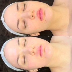 Glamgenics - Brightening custom facial