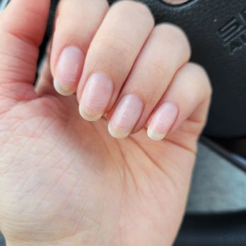 Aborn Nail - This was taken immediately after I left Aborn Nails.  I was so shocked by how damaged my nails were. - Nail Salons Near Me - San Jose, California