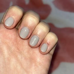 V Nail