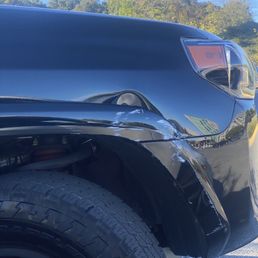 Dent Dent
