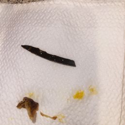 was in my beans - some sharp plastic was in my beans - some sharp plastic