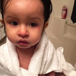 Supposedly a boy hit her with a toy. No one called to notify me of what had happened. This happened on her first day there.