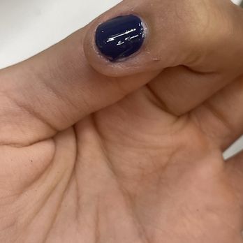 Polish Nails & Spa - dry patched nail - Nail Salons Near Me - Rockville, Maryland