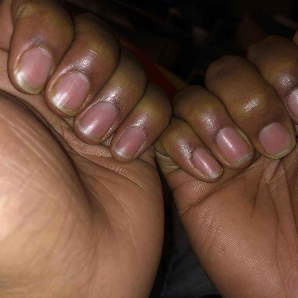 My nails actually look worse after I got them done than when I went in! My nails actually look worse after I got them done than when I went in!