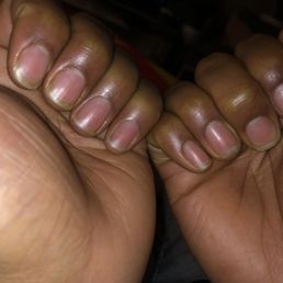 My nails actually look worse after I got them done than when I went in! My nails actually look worse after I got them done than when I went in!