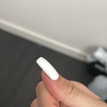 Nails Vision - Side of nail is swollen red and has a pus color with dry blood as well! - Nail Salons Near Me - Houston, Texas Nails Vision - Side of nail is swollen red and has a pus color with dry blood as well! - Nail Salons Near Me - Houston, Texas