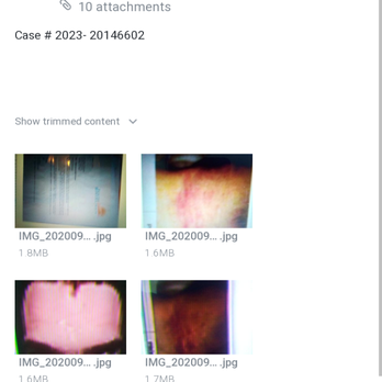 Channel 2 Krem - I can prove physical and sexual abuse through multiple hospitals that's our frontier behavior . - Television Stations Near Me - Spokane, Washington Channel 2 Krem - I can prove physical and sexual abuse through multiple hospitals that's our frontier behavior . - Television Stations Near Me - Spokane, Washington