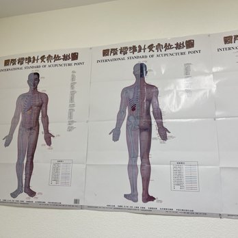 Elk Grove Acupuncture - Acupuncture Near Me - Elk Grove, California Elk Grove Acupuncture - Acupuncture Near Me - Elk Grove, California