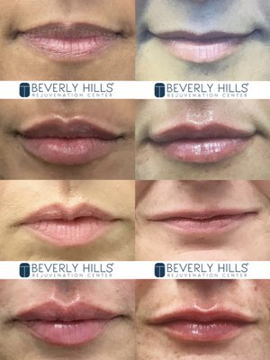 Beverly Hills Rejuvenation Center Westlake Village by null