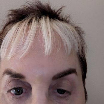 LightRx - Charlotte - Right eye lid droop. - Skin Care Near Me - Charlotte, North Carolina LightRx - Charlotte - Right eye lid droop. - Skin Care Near Me - Charlotte, North Carolina