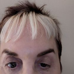 LightRx - Charlotte - Right eye lid droop.