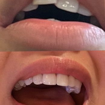Lasting Impressions Dental Spa - Cosmetic Dentists Near Me - Encino, California